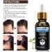 RestoreX Men's Hair Growth Serum S rum De Croissance De Cheveux Anti Chute Cheveux S rum De Cheveux Traitement Pour la Repousse Cheveux huile de pousse des cheveux croissance rapide des cheveux (1pc) - Buy Online on GoSupps.com