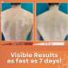 FIONEL 5pcs SkinMedix Psoriasis Herbal Cream - Natural Chinese Anti-Itch Ointment for Face & Body - Buy Online on GoSupps.com