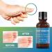 Evagloss Natural Wart Remover - Maximum Strength Liquid Gel for Plantar, Common & Genital Warts - Buy Online on GoSupps.com