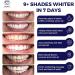 DENTELO Teeth Whitening Strips - Enamel Safe, Zero Sensitivity Formula for a Brighter, Whiter Smile - 42 Count Pack - Buy Online on GoSupps.com