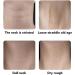 Neck Lift Tape Skin Tightening Face Neck Lift Tape Skin Tone for Dates - Buy Online on GoSupps.com