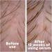 Revium 1-MNA Calming Sensitive Serum Hair Regrowth for Men and Women Sensitive Scalp and Excessive Hair Loss Protects Against Irritations 50 ml - Buy Online on GoSupps.com