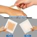 15-Piece Waterproof Adhesive Foam Dressing 3x3 Inch Square Patches with Border - Breathable Wound Bandages for Shower - Silicone Adhesive - Buy Online on GoSupps.com