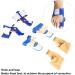 Bunion Corrector with Malleable Gel Packing Hook | Adjustable for Inflammation - Buy Online on GoSupps.com