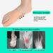 Oumefar Bunion Splint Ultimate Pain Relief & Soft Elastic Fabric for Bunion Protection | International Shipping Available - Buy Online on GoSupps.com