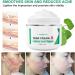 Scar Removal Cream is used to treat scars and stretch marks old and new scars on the face and body (1.7 fl.oz) - Buy Online on GoSupps.com