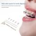 Interproximal Enamel Reduction Kit | Professional Dental Feelers & Polish Strips for Stunning Teeth - International Shipping Available - Buy Online on GoSupps.com