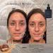 Buy Snail Serum for Anti-Aging | Snail Mucin + XEP-018 | Vitamin C E Niacinamide & Moringa Oil - Hydrate & Revitalize Your Skin - Buy Online on GoSupps.com