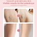 Elorixa Shaver Livora Electric Razor Livora Razor 2 in 1 Hair Trimmer Women Ipx7 Waterproof Wet & Dry Use Shaver with Digital Display for Armpit Leg (Pink) - Buy Online on GoSupps.com