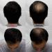 Sevich Unisex Hair Fibers - 5 Seconds to Conceal Hair Loss | Natural Keratin for Thinning Hair | 25g Black - International Shipping Available - Buy Online on GoSupps.com