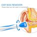 EIGRAMSET Ear Wax Remover Tool Kit - 16 Washable Tips, Safe & Gentle for Kids & Adults - Buy Online on GoSupps.com
