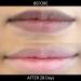 Omorfee Organic Lip Lightening Balm | SPF Lip Balm for Dark Lips | Natural Lip Protection & Repair - 10g - Buy Online on GoSupps.com