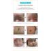 ATO NB Baby Soothing Gel - Cooling Relief for Heated Irritated Skin | Natural Ingredients | EWG Verified | Made in Korea - 5.64 fl oz - Buy Online on GoSupps.com