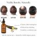 S rum de repousse capillaire Dekohair Soin avanc du cuir chevelu R duit la chute R pare les pointes fourchues et ab m es Cheveux lisses et doux Convient tous types de cheveux 1pcs - Buy Online on GoSupps.com