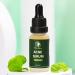 Buy Acne Serum (0.7 fl oz) | Fast International Shipping & Clear Skin Solution - Buy Online on GoSupps.com