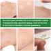 Acne Healing Patch Acne Absorbing Cover Invisible Skin Acne Treatment Stickers for Facial 24Patches acne treatment - Buy Online on GoSupps.com