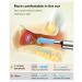 1080P Ear Wax Removal Tool Telescopic Otoscope with 6 LED Lights 7 Ear Picks & 10 Silicone/Metal Spoons International Shipping Available - Buy Online on GoSupps.com