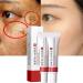 2Pcs Whitening Freckle Cream Acne Scar Removal Treatment Cream Pigmentation Removal Cream for Face Effectively Removes Facial Melasma Dark Spots Blemishes