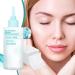 Nose Skin Cleansing Liquid Nose Skin Dirt Extraction Liquid 150ml With Pads NonGreasy Refreshing Facial Care For Women - Buy Online on GoSupps.com