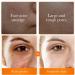 Buy Turmeric Facial Cleanser | Foaming Face Wash for All Skin Types - Shop Internationally - Buy Online on GoSupps.com