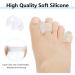 Jinlingnb 4 Pairs Transparent Toe Spreaders - Correct Bunion Pain Gel Spacers for Overlapping Toes Relief - Buy Online on GoSupps.com