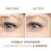 BEE and YOU Eye Cream - 100% Natural Anti-Aging & Anti-Wrinkle Serum with Bee Venom & Hyaluronic Acid | Dark Circles & Puffiness Treatment | 15ml - Buy Online on GoSupps.com