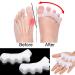 zoerbufan Toe Separators 3 Pair Toe Stretcher for Overlapping Toes to Relax Toes Silicone Toe Straighteners for Hallux Valgus Soft Gel Toe Spacers for Correct Bunions (Transparent) - Buy Online on GoSupps.com