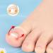 Silicone Ingrown Toenail Correcting Tool Flexible and Elastic Washable and Reusable Wear Resistant Silicone with Walkable Design for Daily Use - Buy Online on GoSupps.com