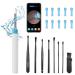 AVM Ear Wax Removal WiFi Wireless Ear Wax Remover Kit with 8 Pieces Traditional Ear Picks 1080P FHD Ear Camera Ear Cleaner with App Control IP67 Waterproof for iOS&Android-Adults Kids Pets(White)
