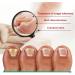 Fungus Treatment Oil Foot Fungus Oil Kerasentials Nail Treatment Healthy Natural Repair Nails Natural Toenail for Damaged & Discolored Toe Nails (2pcs) - Buy Online on GoSupps.com