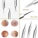 Usiveinborn Blackhead Remover Usiveinborn Tweezers Professional Stainless Steel Facial Blackhead Remover Tweezers Blackhead Tweezers Professional (8pcs) - Buy Online on GoSupps.com
