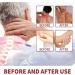 3 Pieces Todahof Bienergiftsalbe - Bee Cream for Pain Relief & Psoriasis Treatment | 1g Pack - Fast International Shipping - Buy Online on GoSupps.com