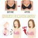 BROWSLU Breast Enhancement Patch - Upright Lifter & Enlarger Mask, 2 Boxes - Buy Online on GoSupps.com