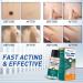 Wart Remover Liquid - Fast & Effective Treatment for Plantar & Common Warts | Safe Botanical Formula - Buy Online on GoSupps.com