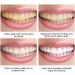Yan Jiayi Bamboo Coal Deep Cleaning Toothpaste - Activated Carbon Tooth Stain Removal & Breath Freshening | Pack of 3 - Buy Online on GoSupps.com