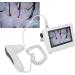 Skin Hair Analyzer 5 Inch Screen Skin Diagnosis Scanner 50x Lens and 200x Lens Detect Various Skin Scalp Hair and Follicle Issues Suitable for Beauty Salons/Skin Management Institutions