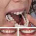 FCcassiel 2 PCS Fake Teeth Veneers Dentures for Women Men - Temporary Tooth Repair and Comfortable Dental Veneers - Protect Your Teeth and Regain Confident Smile - Multicolor - Buy Online on GoSupps.com