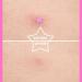 AUSLKA Star Blemishes Patches - 156 Hydrocolloid Dots for Facial Blemishes - Pimple Stickers 156 Count - Buy Online on GoSupps.com
