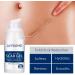 KLiHDSM Scar Removal Cream 30g - Stretch Marks & Surgical Skin Repair Gel for Whitening & Smoothing - Beauty Treatment for Scars and Burns - Buy Online on GoSupps.com