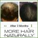 More Hair Naturally 9 - Advanced Stem Cell Therapy for Thinning Hair - Buy Online on GoSupps.com