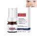Aobenz Serum Aobenz Whitening and Freckle Removing Essence Aobenz Anti-Spot Serum Aobenz Spot Remover Serum Aobenz Dark Spot Correcting Serum Aobenz Spot Remover for Face Wrinkle Power (1pc)
