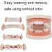Plated Gold Grillz Teeth Brace Decoration Halloween Teeth with 2 Silicon Molding Bars Different 3 Colors Fake Teeth Brace for Halloween Parties/Hip Hop Fashion Shows/Music Concerts(Rose) - Buy Online on GoSupps.com