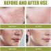 EXQST Advanced Whitening and Lightening Cream Anti-Freckle and Whitening Cream Lightening and Whitening Cream Body Whitening Cream - Buy Online on GoSupps.com