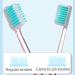 Soft Bristle Toothbrush for Gentle Dental Care | Effective Cleaning & Removal Set - Shop Internationally - Buy Online on GoSupps.com