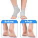 DCC-GETS Moisturizing Gel Socks for Women- 2 Pairs, Cracked Heel Treatment- Beige - Buy Online on GoSupps.com