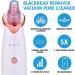 Benkeg Blackhead Remover - Electric Blackhead Suction Device with 5 in 1 Pimple Zit Comedone Extractor Tool Acne Removal kit Blackhead Remover Household Face Pore Cleaner Cosmetic Instrument White with 5pcs needles - Buy Online on GoSupps.com