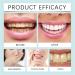 Skavix Peinture Blanchiment Dentaire Skavix Vernis Dentaire Blanc Peinture De Blanchiment Des Dents Instantan e Dent Blanche Pour liminer Les Taches Teeth Whitening Tooth Polish (3) - Buy Online on GoSupps.com