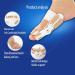 2 Pack Pedic Toe Straightener Corrector | Adjustable Hallux Valgus Support | Skin-Friendly for Men & Women | Improve Foot Comfort - Buy Online on GoSupps.com