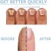Nail Growth and Repair Serum Nail Strengthening and Growth Conditioner Nourish Strengthen And Revitalize Your Nails (1 Pcs) - Buy Online on GoSupps.com