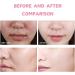 Face Scrub Exfoliator - Sakura Extract Face Exfoliator - Exfoliating Face Wash for Hydrating Moisturizing - Face Wash Women Blackhead Remover Shrink Pores - Clean and Clear Face Wash - Face Scrub 50g - Buy Online on GoSupps.com
